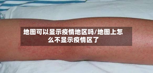 地图可以显示疫情地区吗/地图上怎么不显示疫情区了-第2张图片