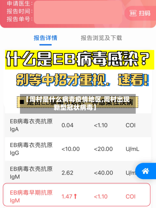 【周村是什么病毒疫情地区,周村出现新型冠状病毒】-第1张图片