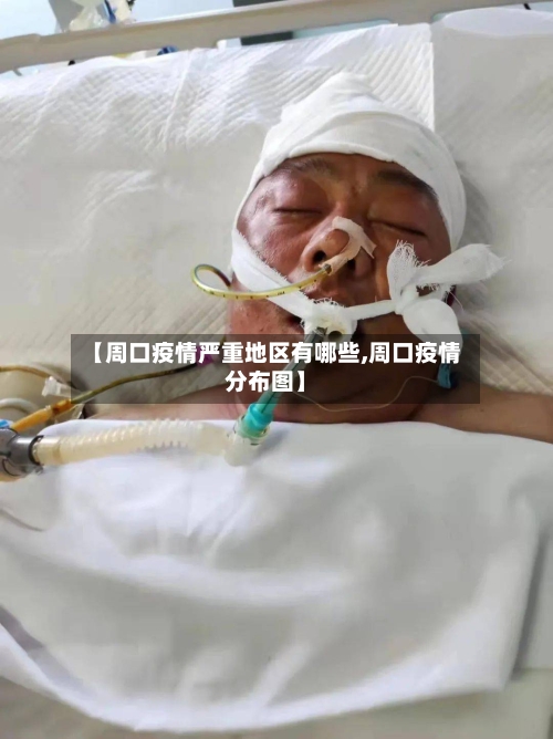 【周口疫情严重地区有哪些,周口疫情分布图】-第1张图片